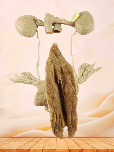 Female urogenital system plastinated specimen