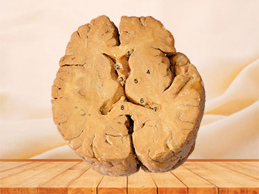 Horizontal section of human brain plastinated specimen