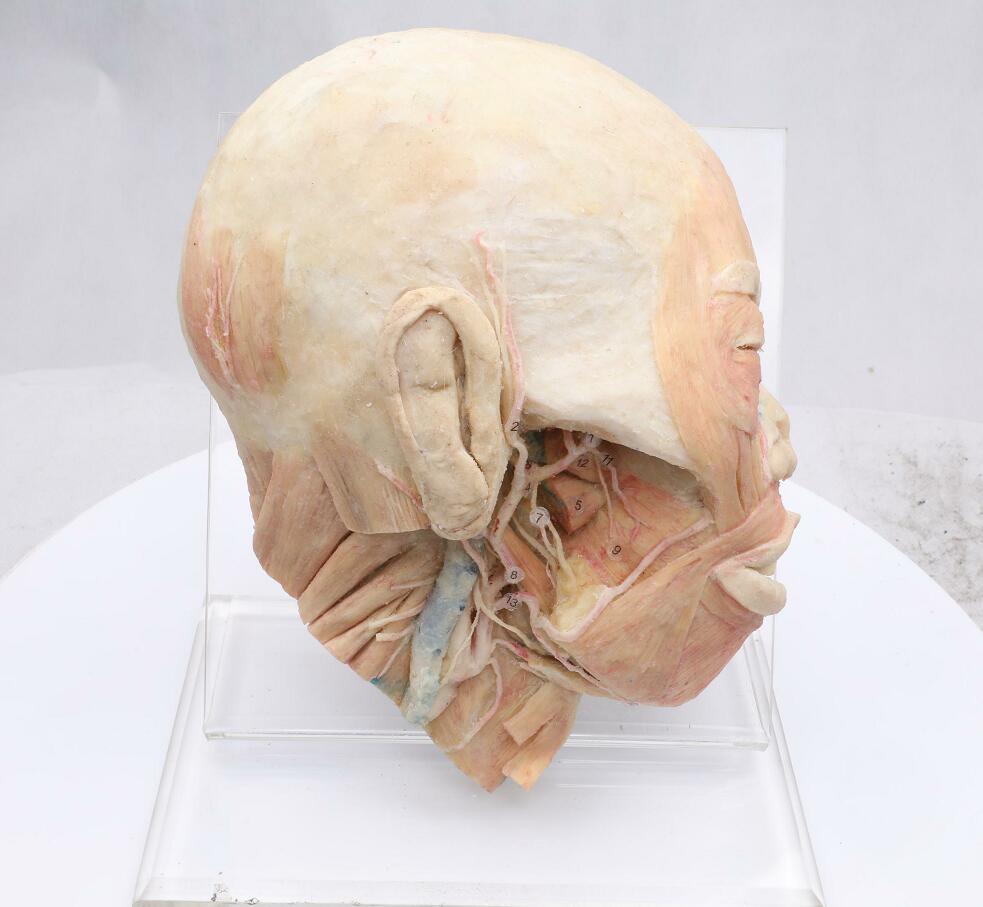 superficial muscles of head and neck plastinated specimen