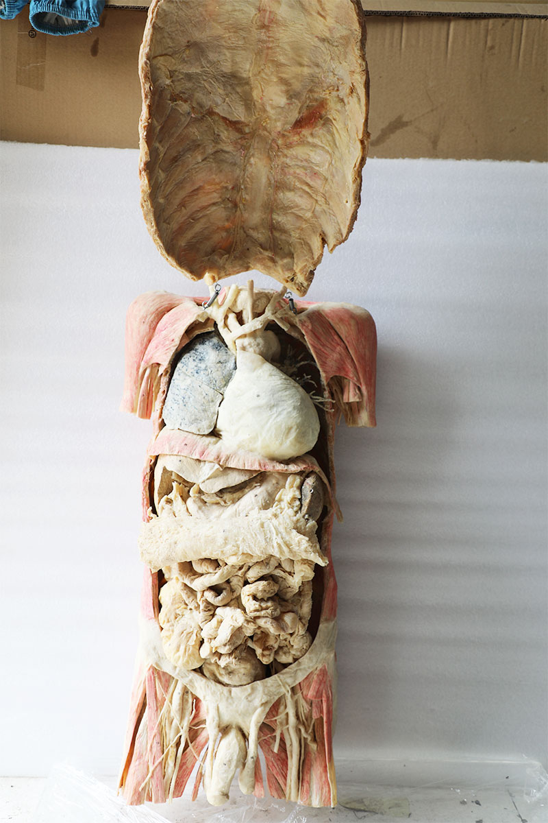 plastinated torso