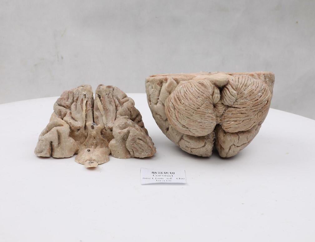 plastinated human brain