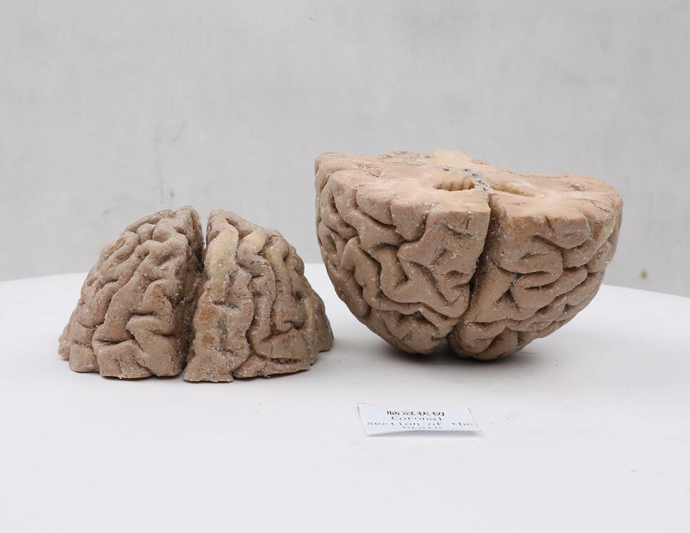 coronal section of plastinated brain
