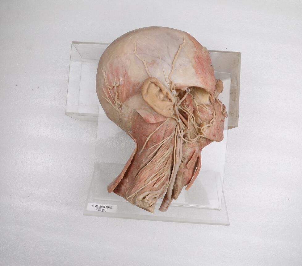deep vascular nerves of human head and neck plastinated model