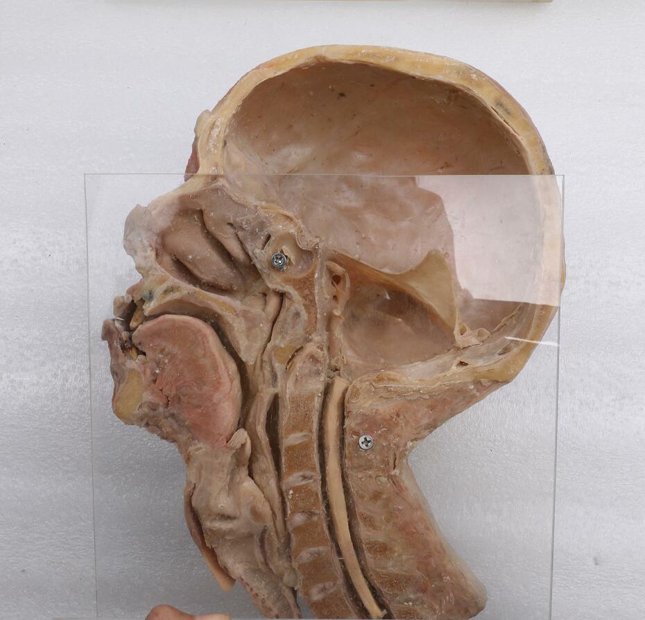 head and neck plastinated model