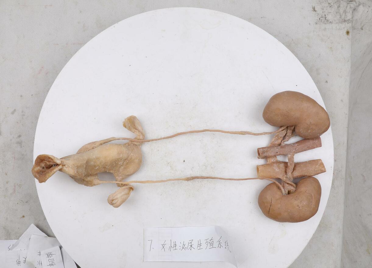 plastinated female urogenital system