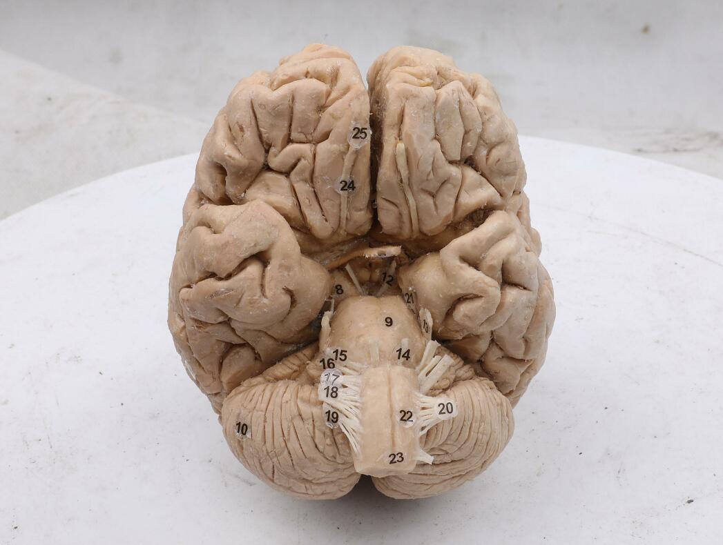 plastinated human brain