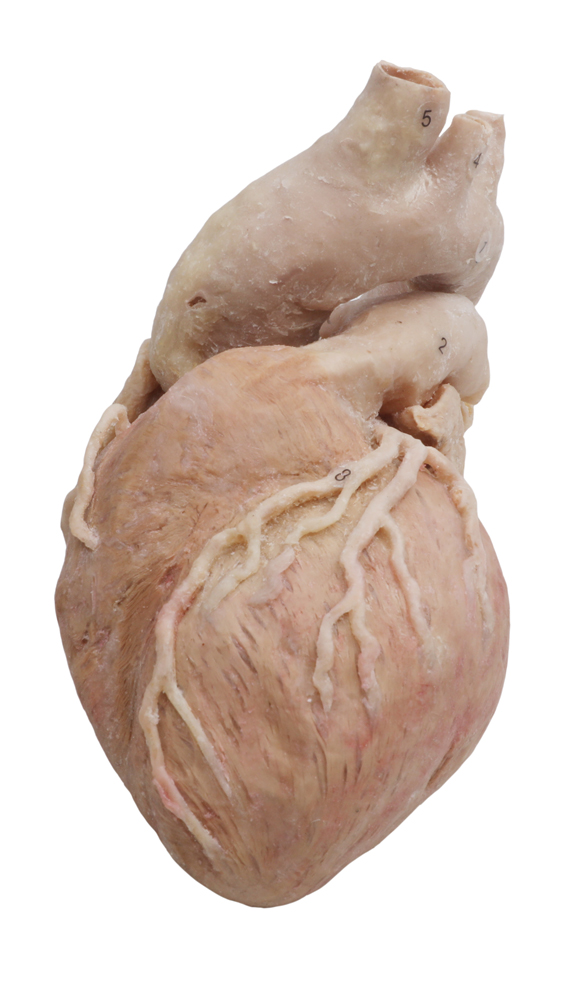 plastinated heart