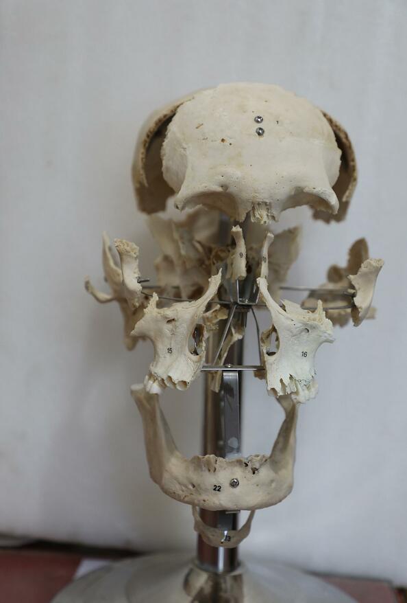 human skull bones