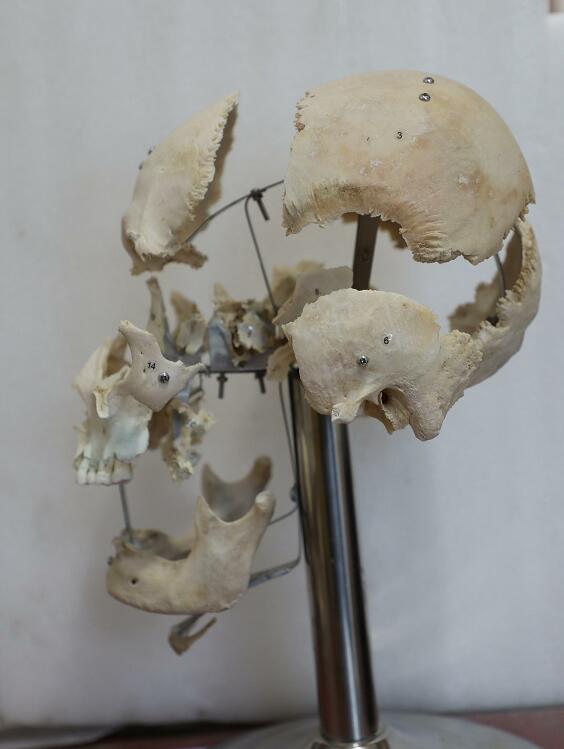 real human skull