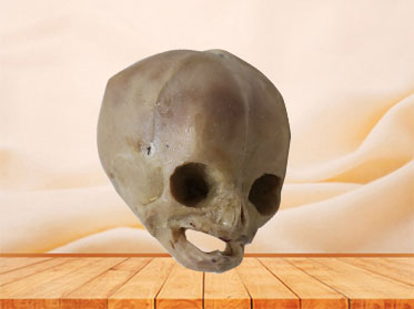 Plastinated infant