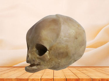 plastinated infant for medical education