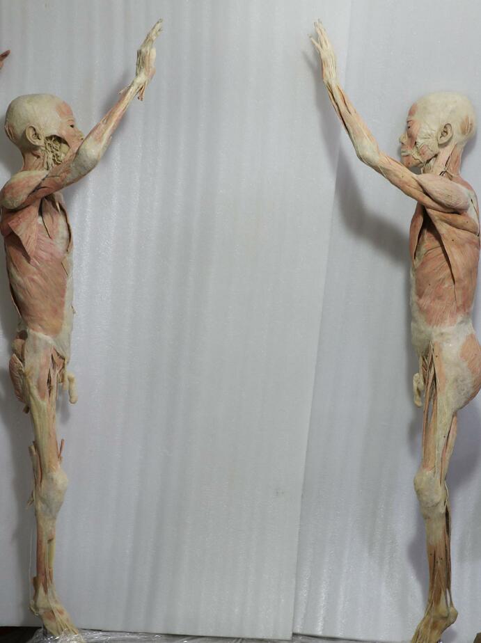 male body plastination