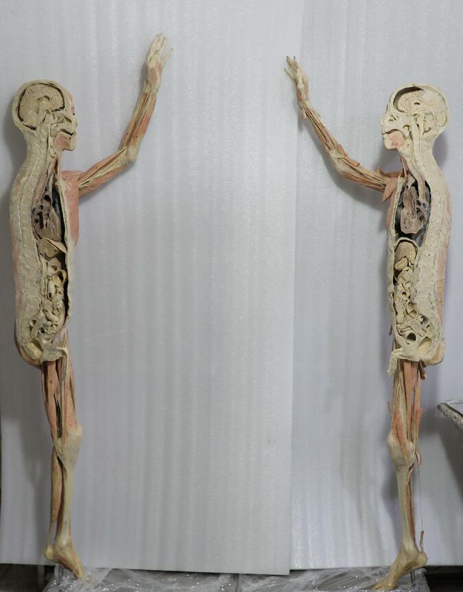dissection of male body plastination