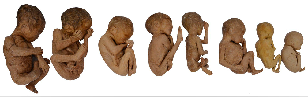 plastination fetus models