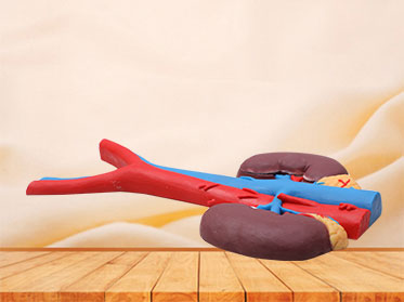 Human Kidney and blood vessels soft silicone anatomy model for sale