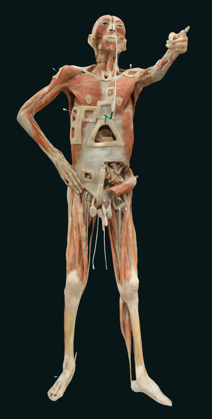 plastinated body