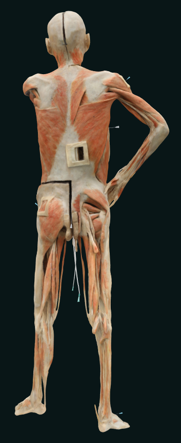 plastinated human body