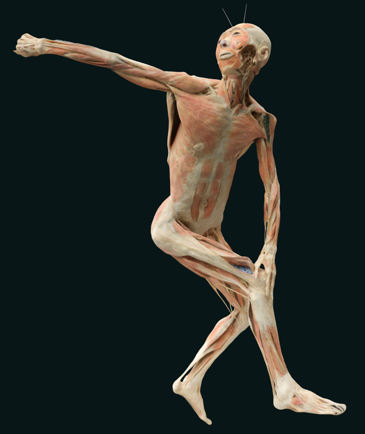 body plastination