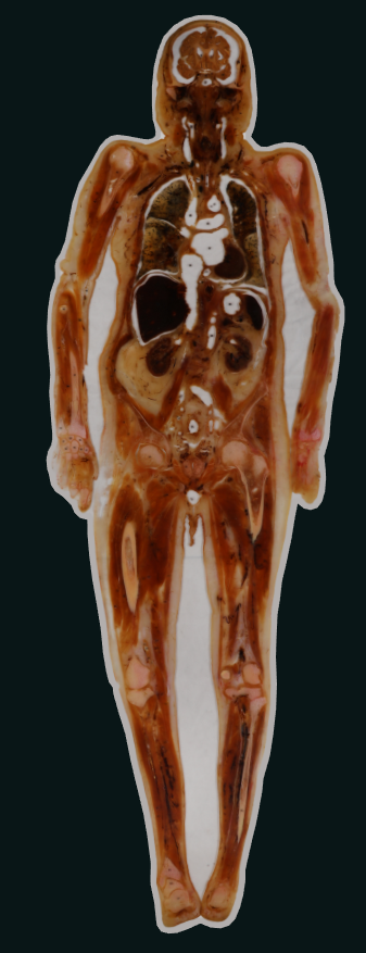coronal body slices embedded specimen