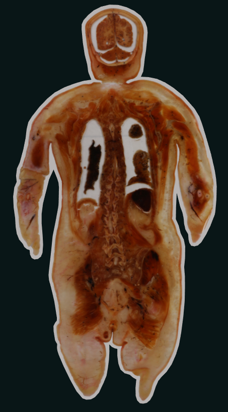 coronal section of whole body embedded specimen