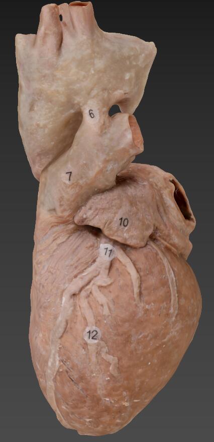 plastinated human heart and blood vessels