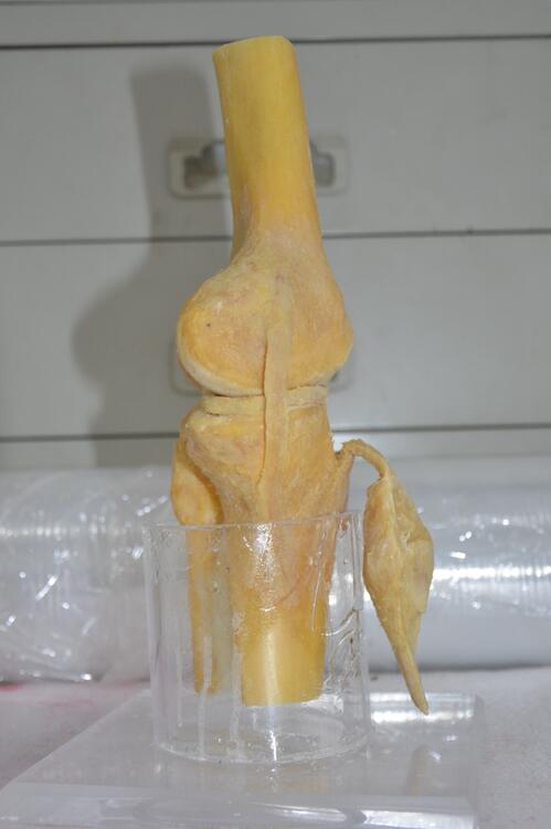 plastination knee joint specimen
