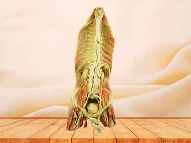 Azygos system plastination