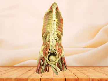 Azygos system specimen
