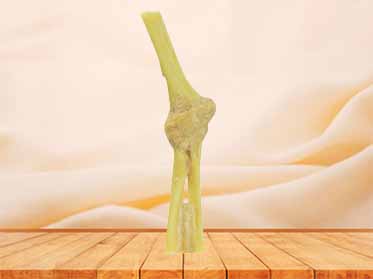 Elbow joint