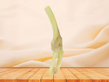 Elbow joint anatomy specimen