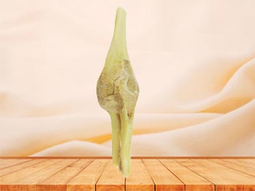 Elbow joint medical specimen