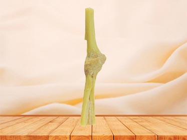 Elbow joint specimen