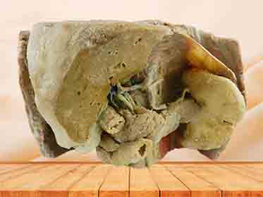 Liver spleen pancreas  and duodenum for sale