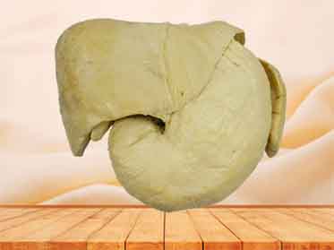Liver stomach and spleen for medical students