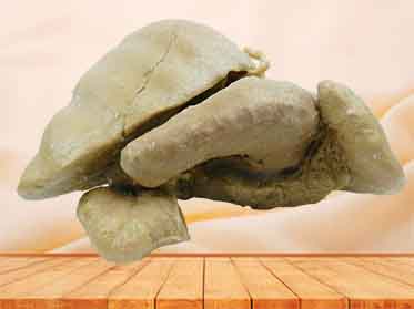 Liver stomach and spleen plastination