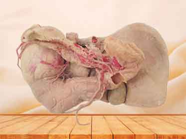 Liver stomach pancreas and duodenum