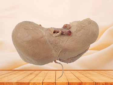 Liver stomach pancreas and duodenum plastination