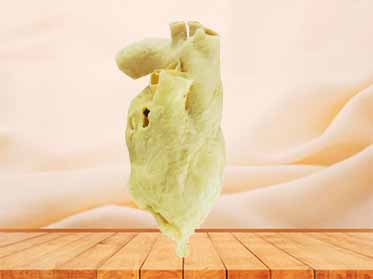 Pericardium plastinated specimen