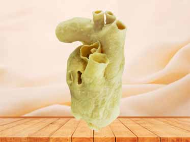 Pericardium plastination