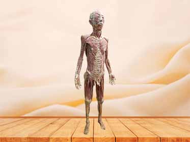 acupuncture people plastination