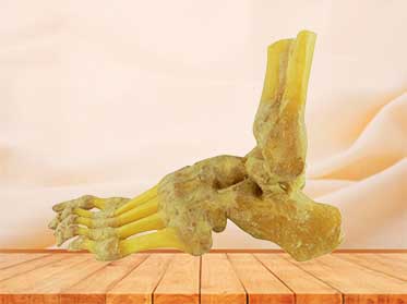 foot joint medical specimen