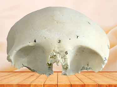 frontal bone specimen