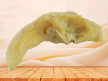 human body part plastination