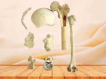 human bone specimen