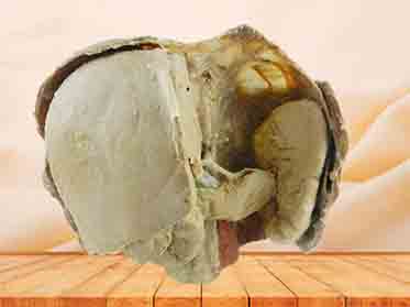 human plastinated specimen