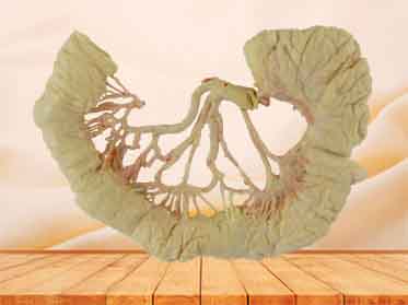 intestinal arcades plastination