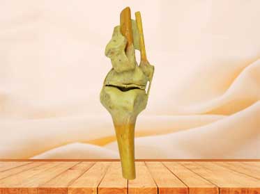 knee joint anatomy specimen