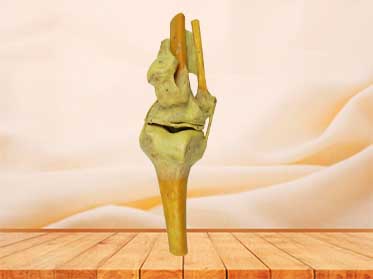 knee joint specimen