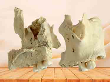 maxilla specimen