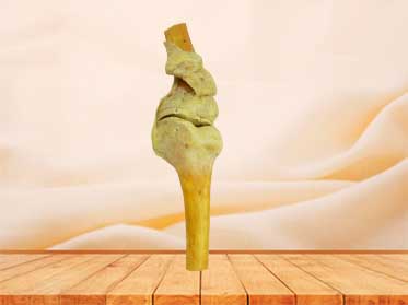 medical knee joint specimen